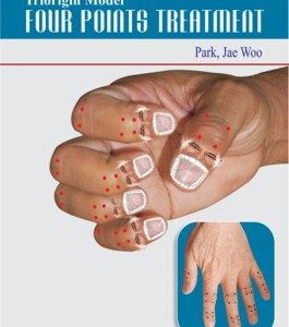 Triorigin Model Four Points Treatment